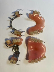 MATERIEL MEDICAL Dentiers