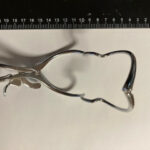 MATERIEL MEDICAL Ecarteur de chirurgie